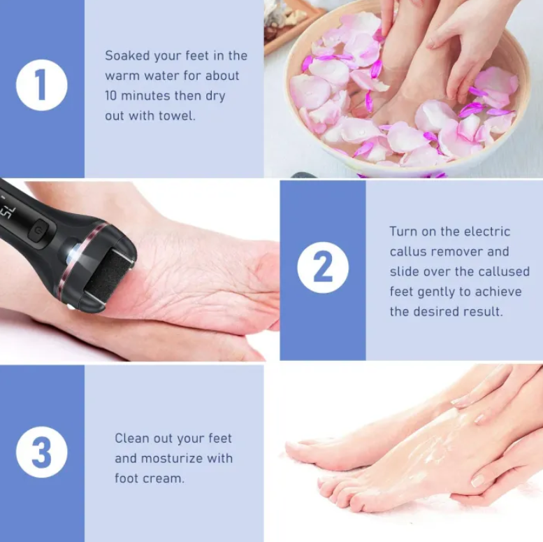 Foot Dead Skin Grinder